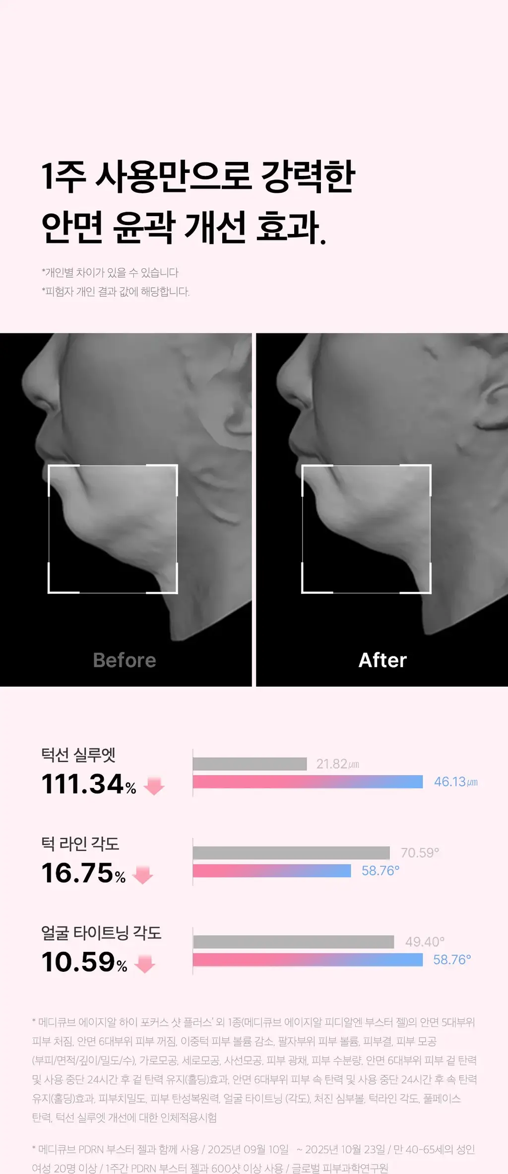 [고강도초음파] 메디큐브 에이지알 하이포커스샷 플러스 (핑크/베이지) 상세페이지 24